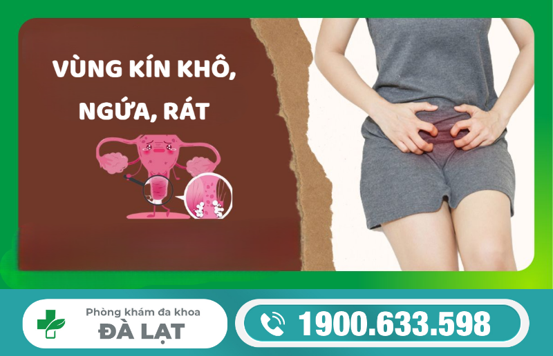 Hình ảnh minh họa